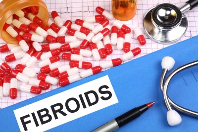 Understanding Fibroids and Ovarian Cysts
